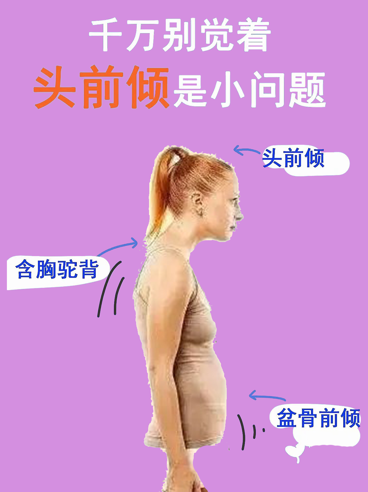 头前倾,可不是小问题