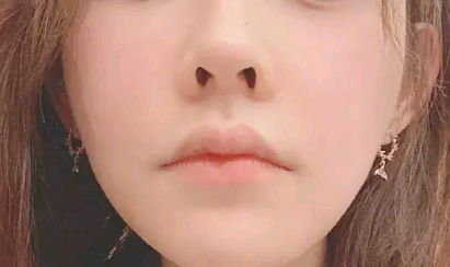 鼻孔瞩目超宽双眼皮一线主播整容后遗症太吓人变化太大了
