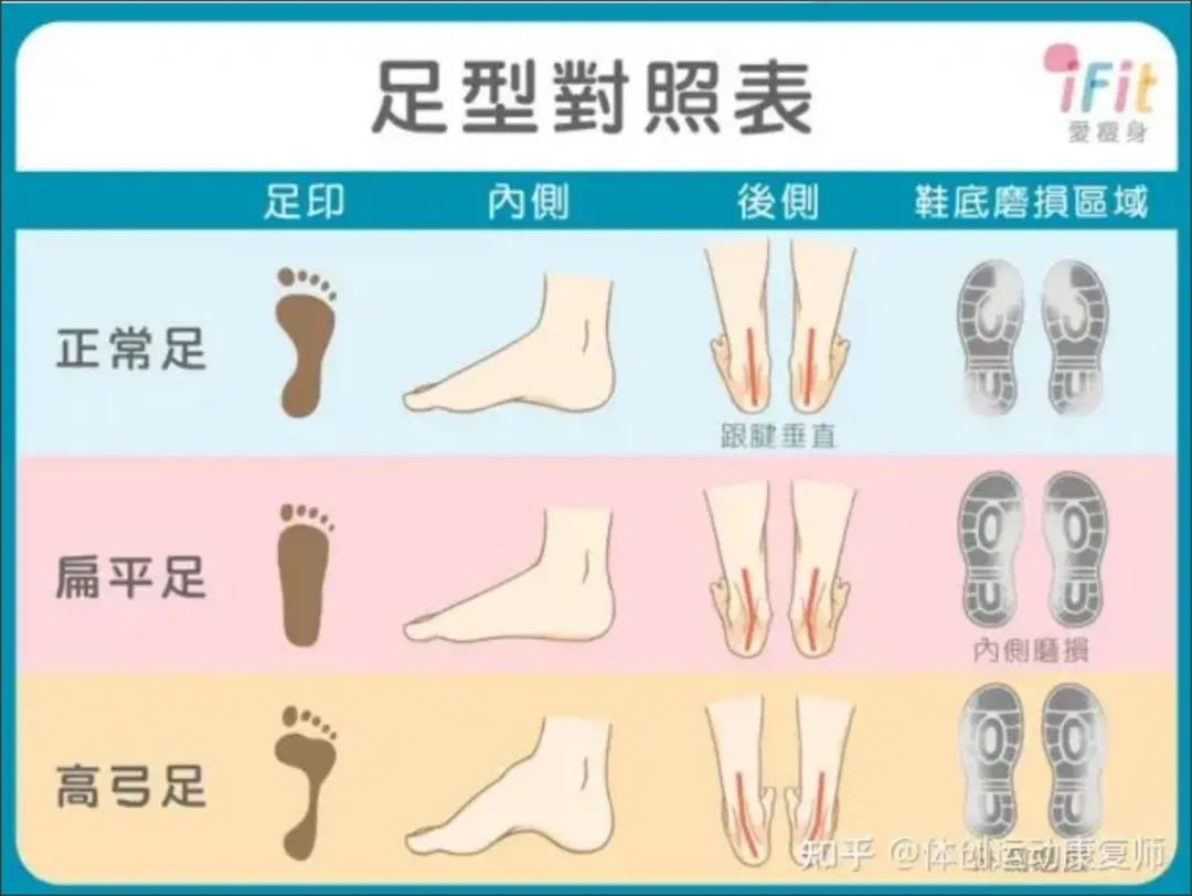 足弓与扁平足 | 足踝科普系列