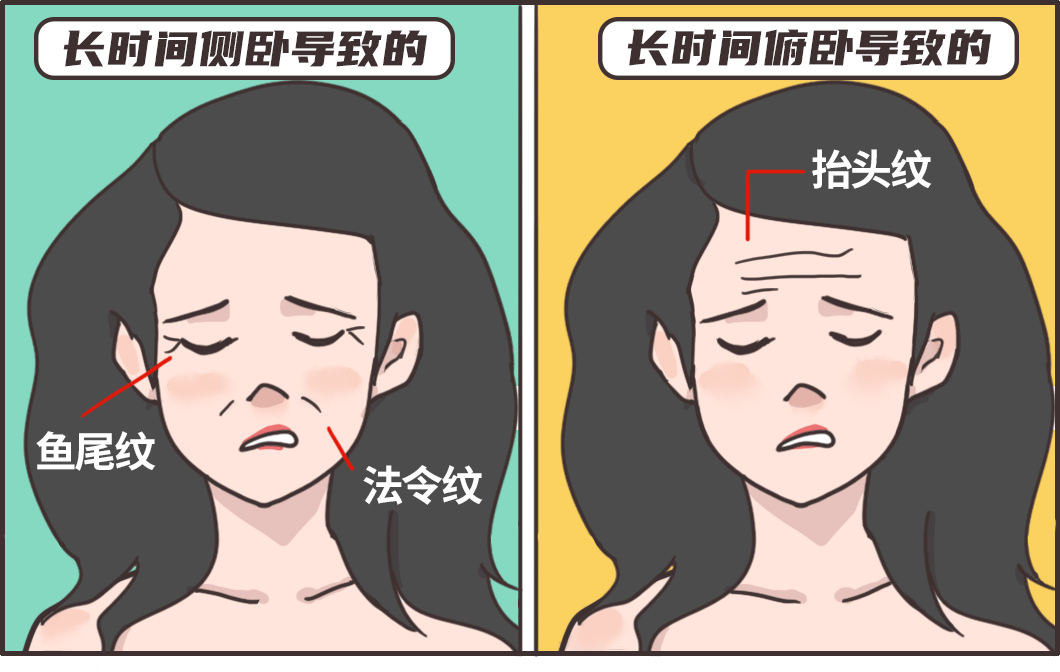 「睡眠皱纹 能不能自行缓解 关键要看真皮层的状态.