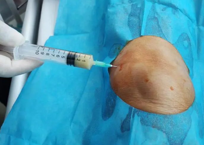 什么是"封闭针"?原理是什么?长期打会引发什么后果?