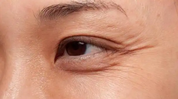 5个加重眼周皱纹的坏习惯,快别做了!太多人中招