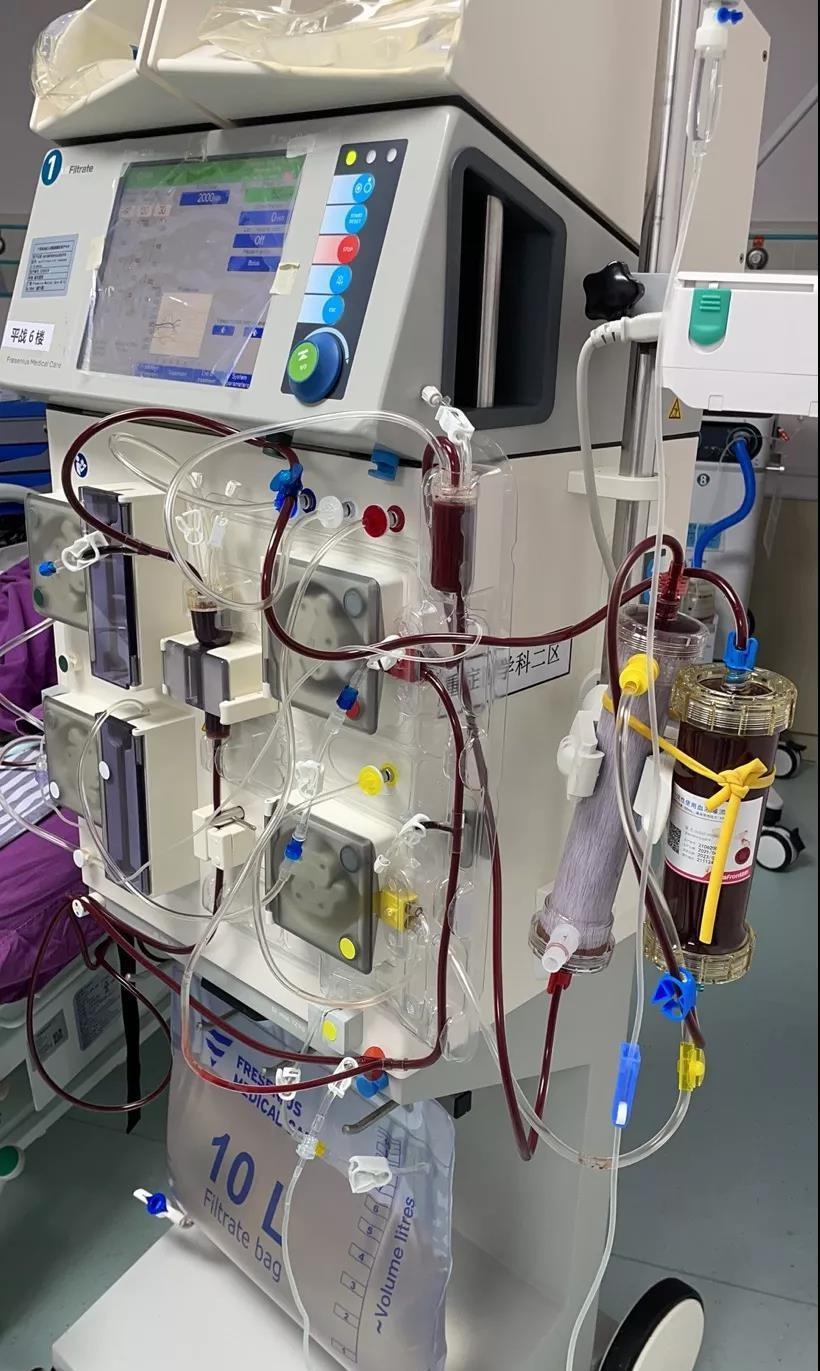 自治区人民医院重症医学科北院院区开展首例双重血浆置换术