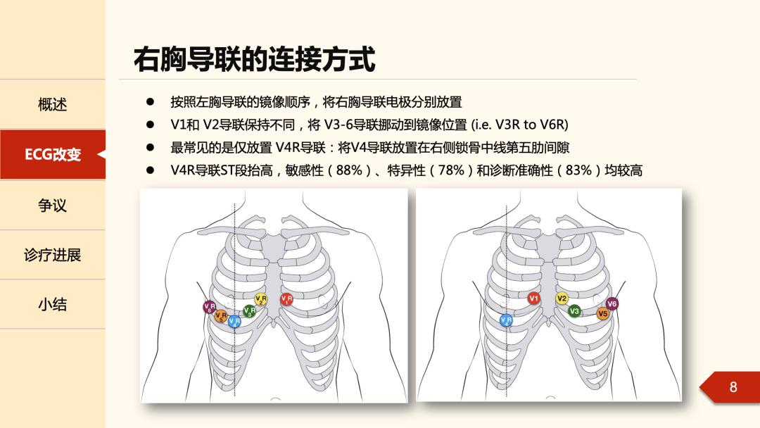 做心电图的位置图片