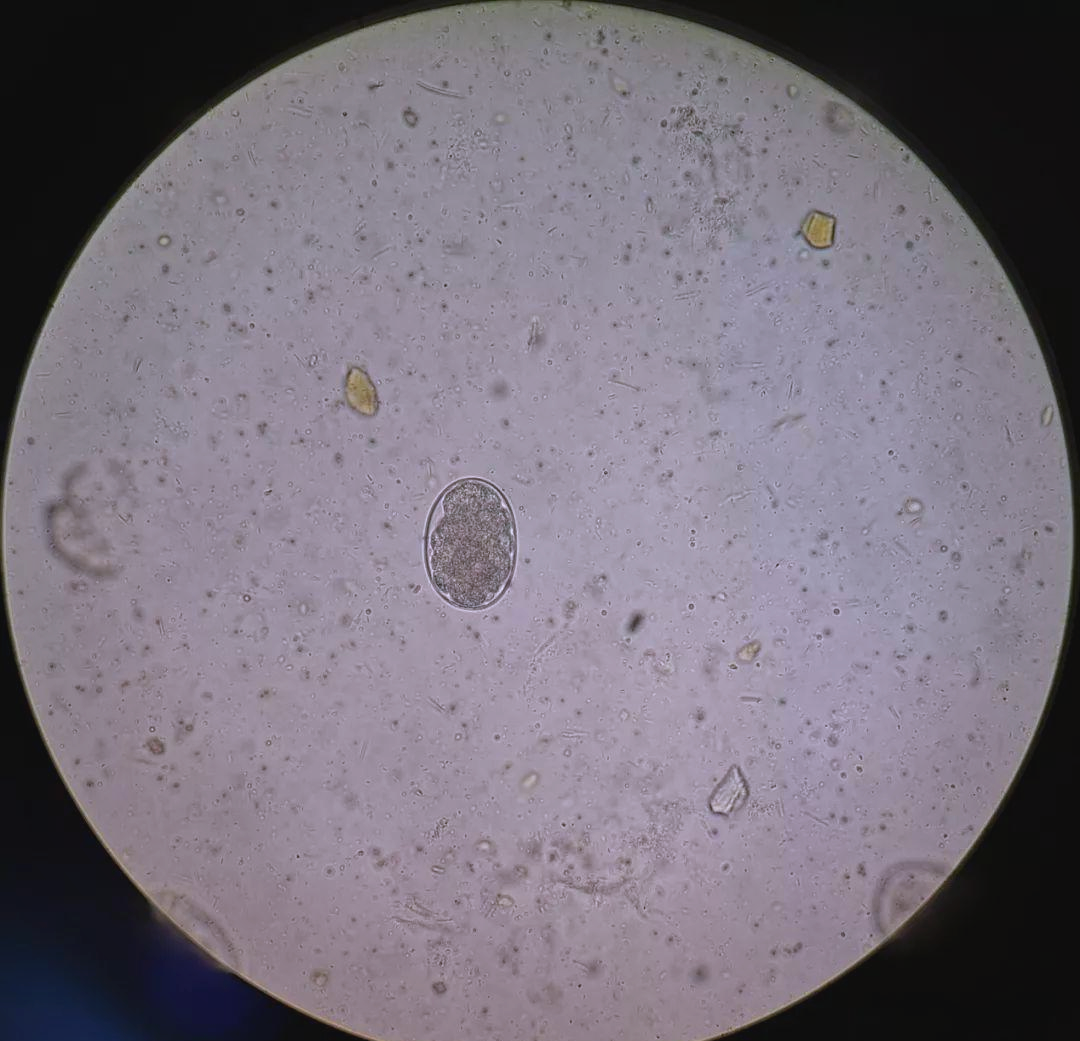 二,第二,三日的观察显示,钩虫卵的大小约为