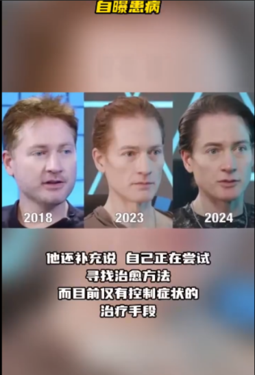 美国亿万富翁为求生又整活！换血失败后 转而用基因克隆了自己