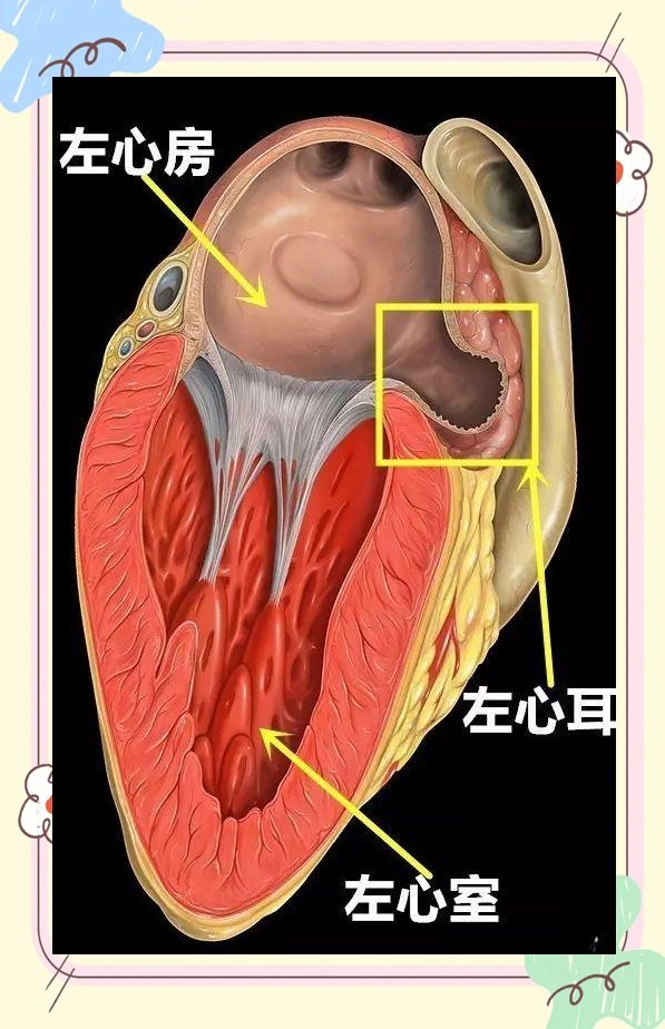 左心耳:心脏血栓风险与防治策略全解析