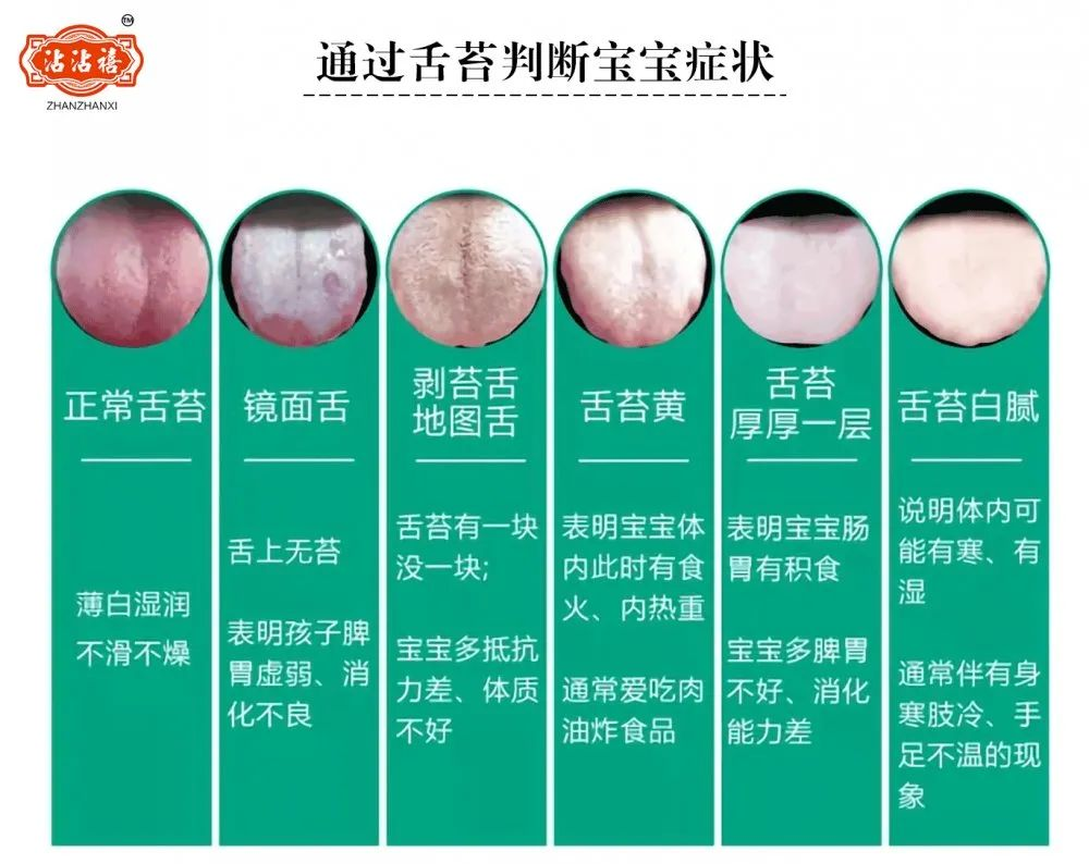 孩子频繁出现地图舌的原因及调理方法