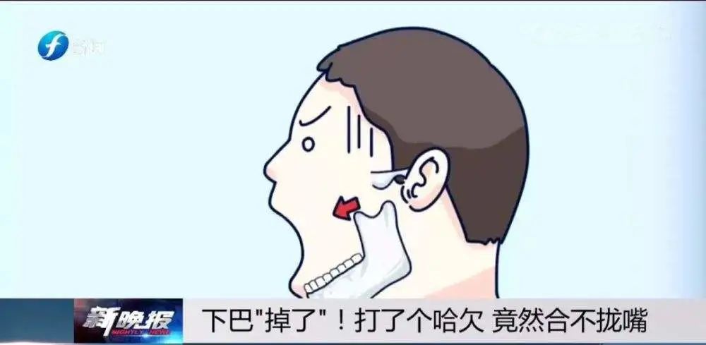 【小南话科普】笑着笑着,他的下巴掉了.