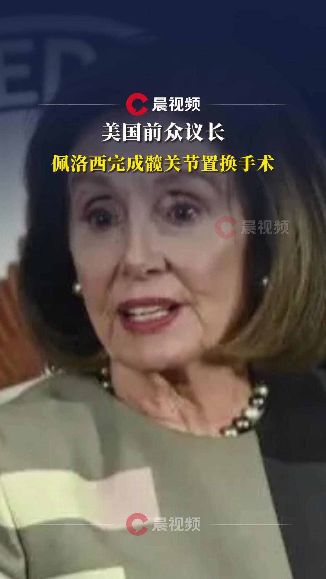 美国前众议长佩洛西完成髋关节置换手术