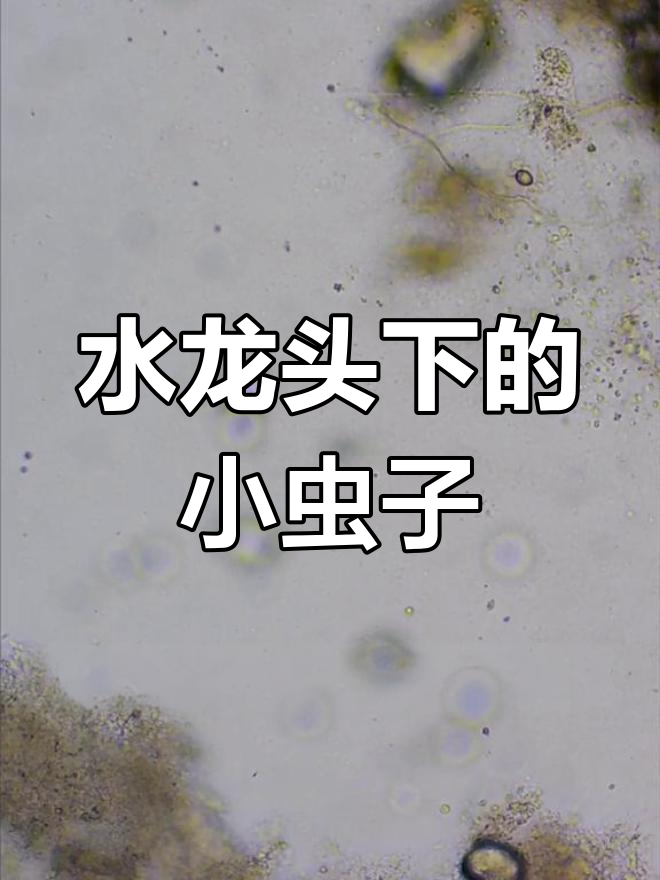 青苔下的微观世界:浮游生物与净化水的作用