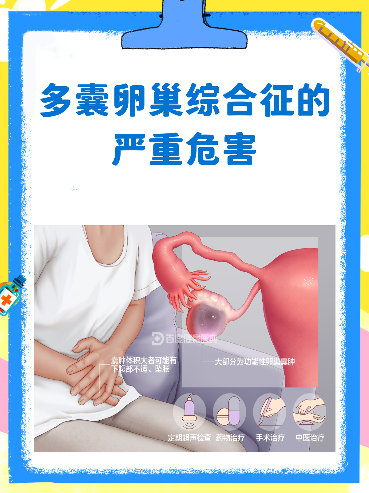 多卵巢多囊是什么症状_多卵巢多囊是什么症状表现