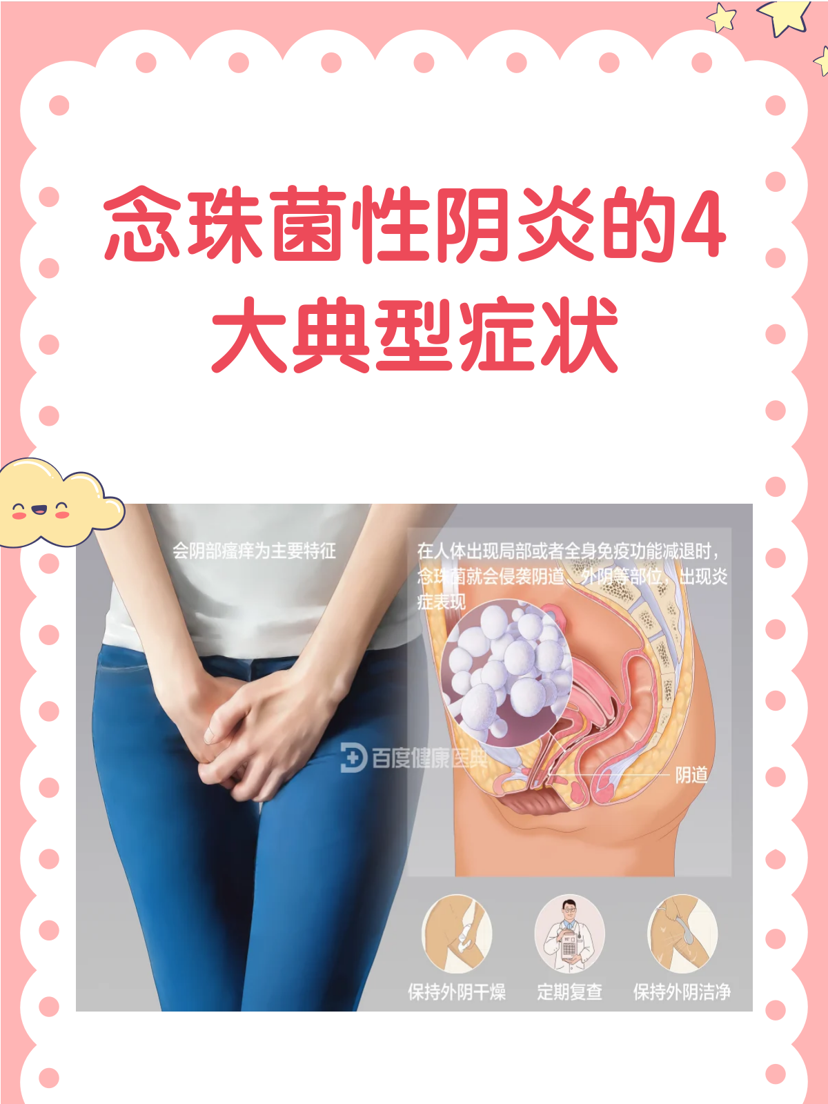 念珠菌性阴炎来袭!这些症状你中招了吗?