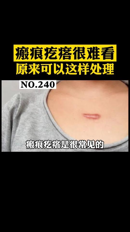胸前容易长瘢痕疙瘩,看起来特别难看,有什么办法可以处理呢