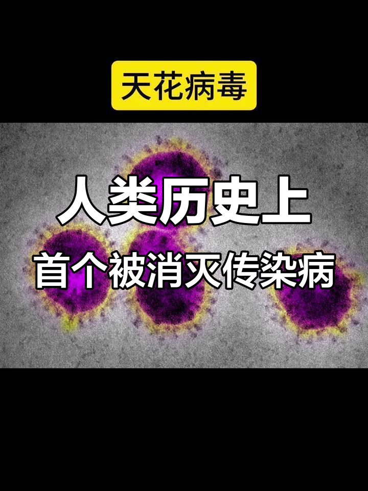  中国非典病毒是哪一年发现的呢图片(中国非典是哪一年发生的,持续了多久)