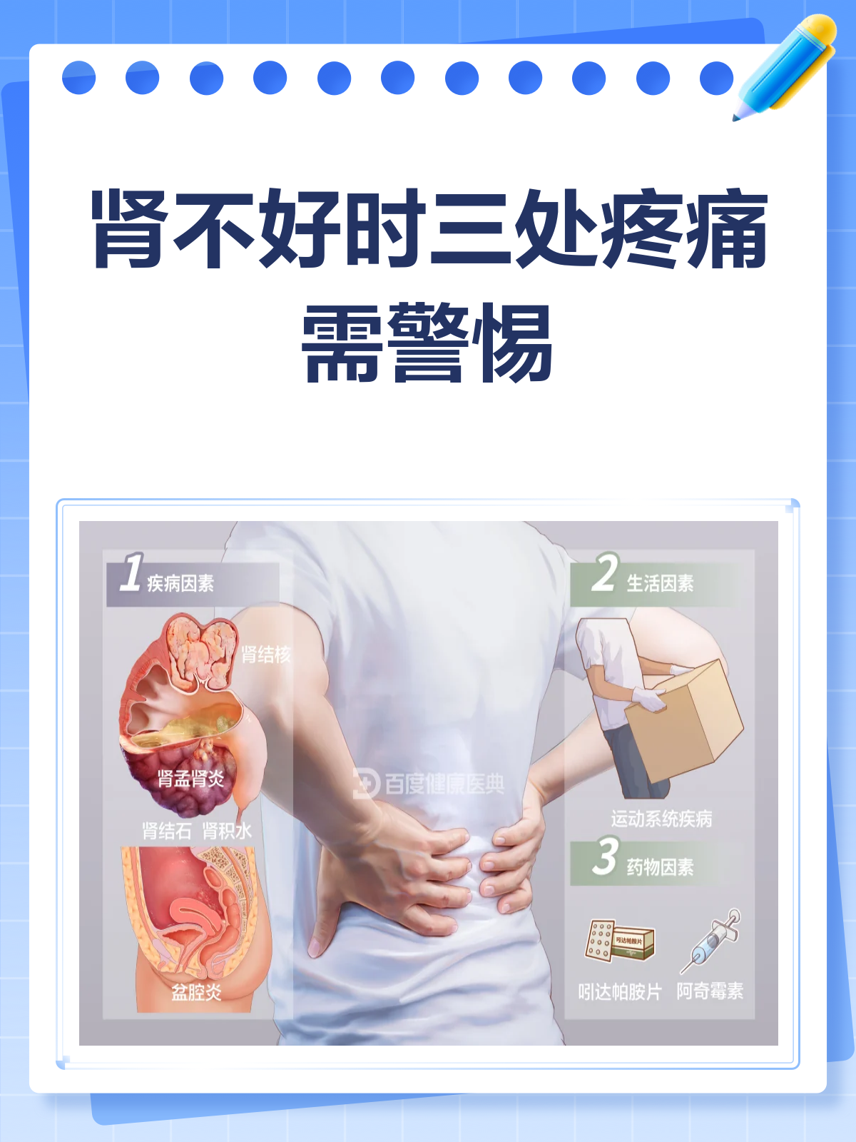 肾不好哪里会痛?这三处疼痛要警惕!