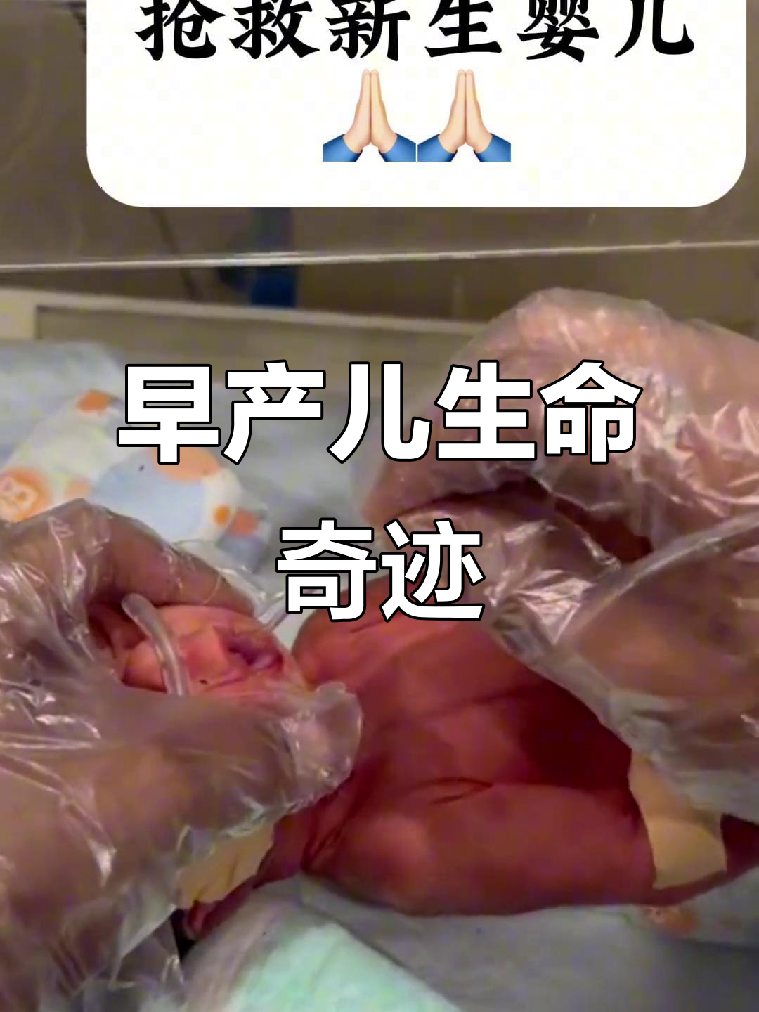 33周提前出生的宝宝,生命力超乎想象
