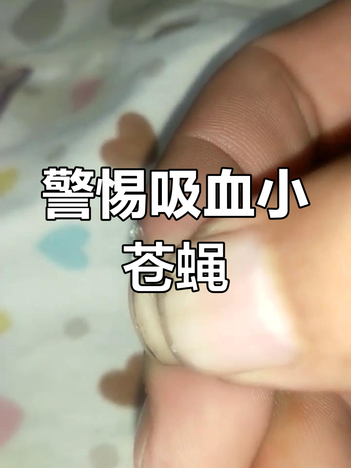 吸血苍蝇来袭,小心被咬!