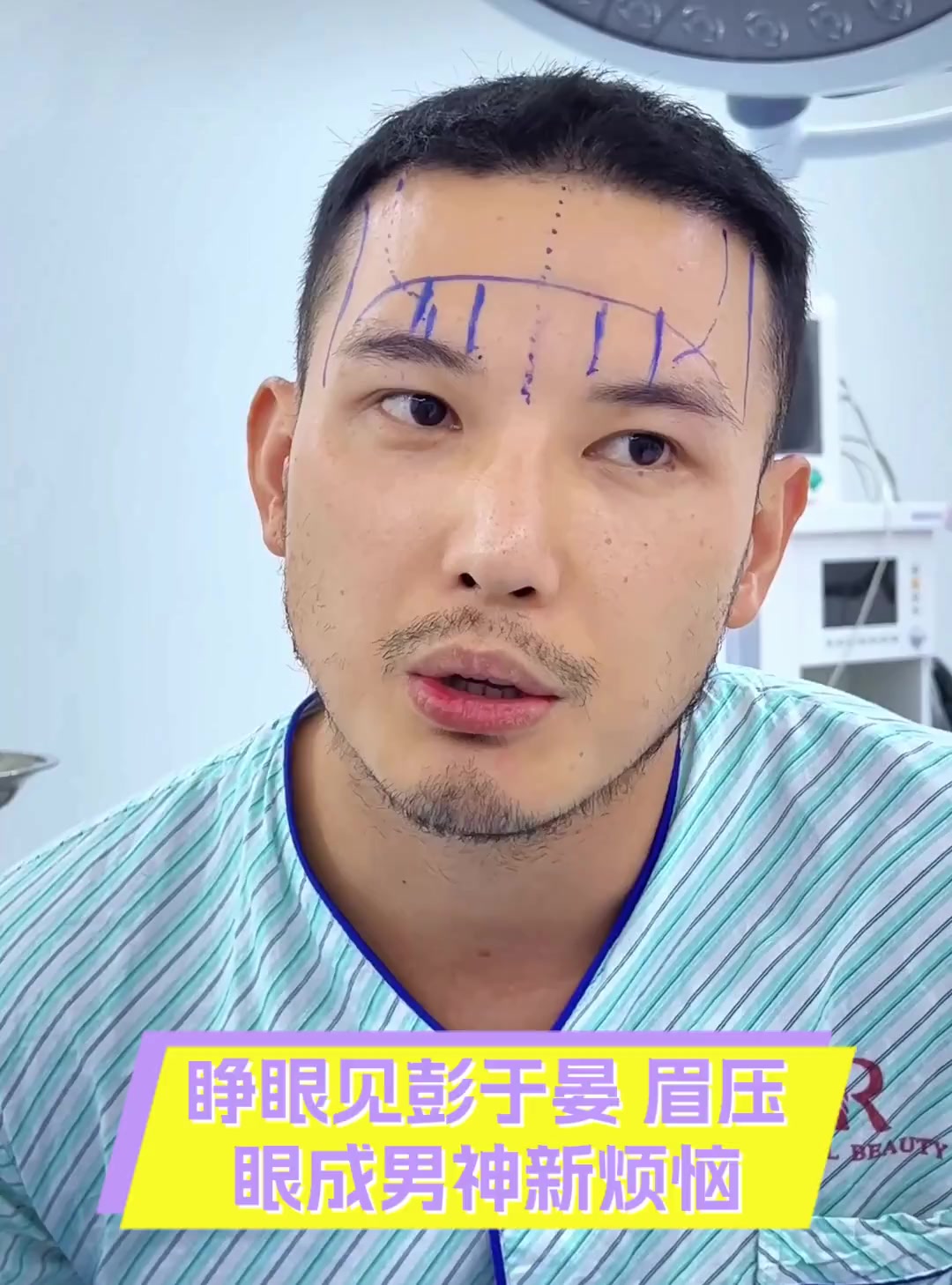 为什么帅哥都是眉压眼