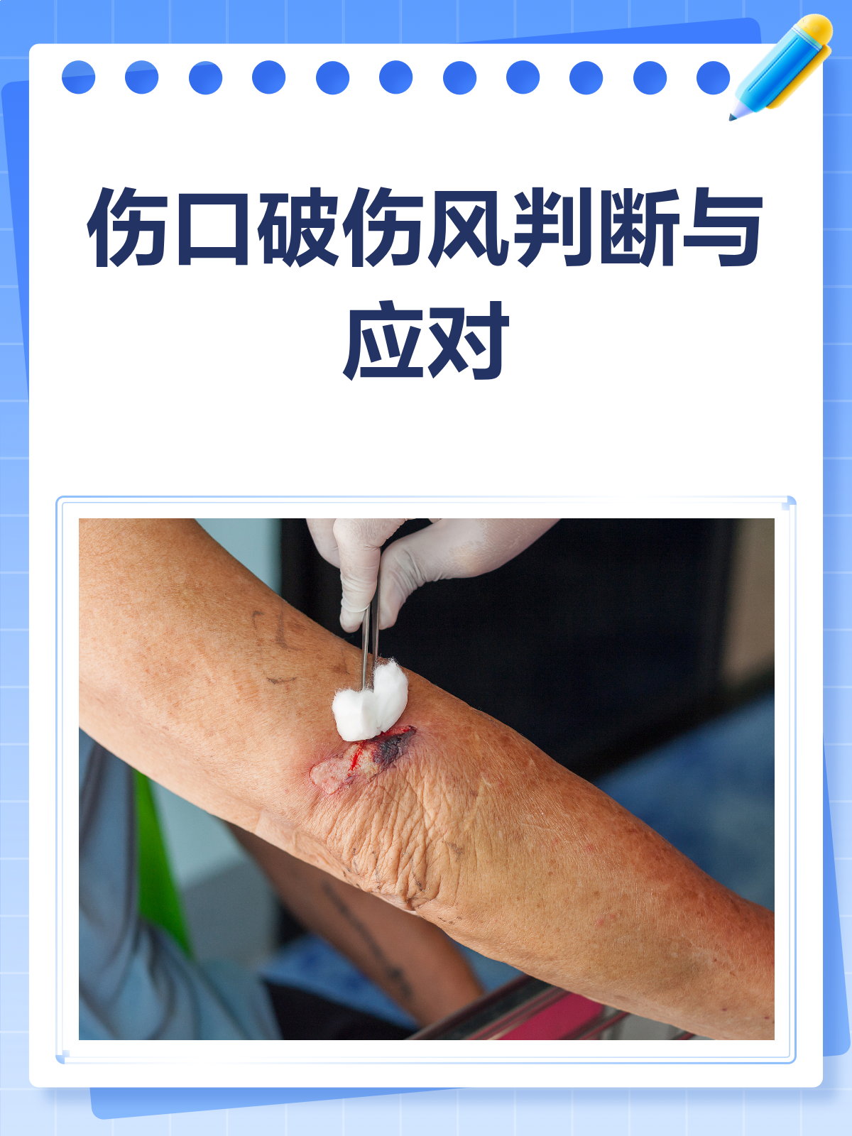 伤口破伤风?一文教你识别与应对