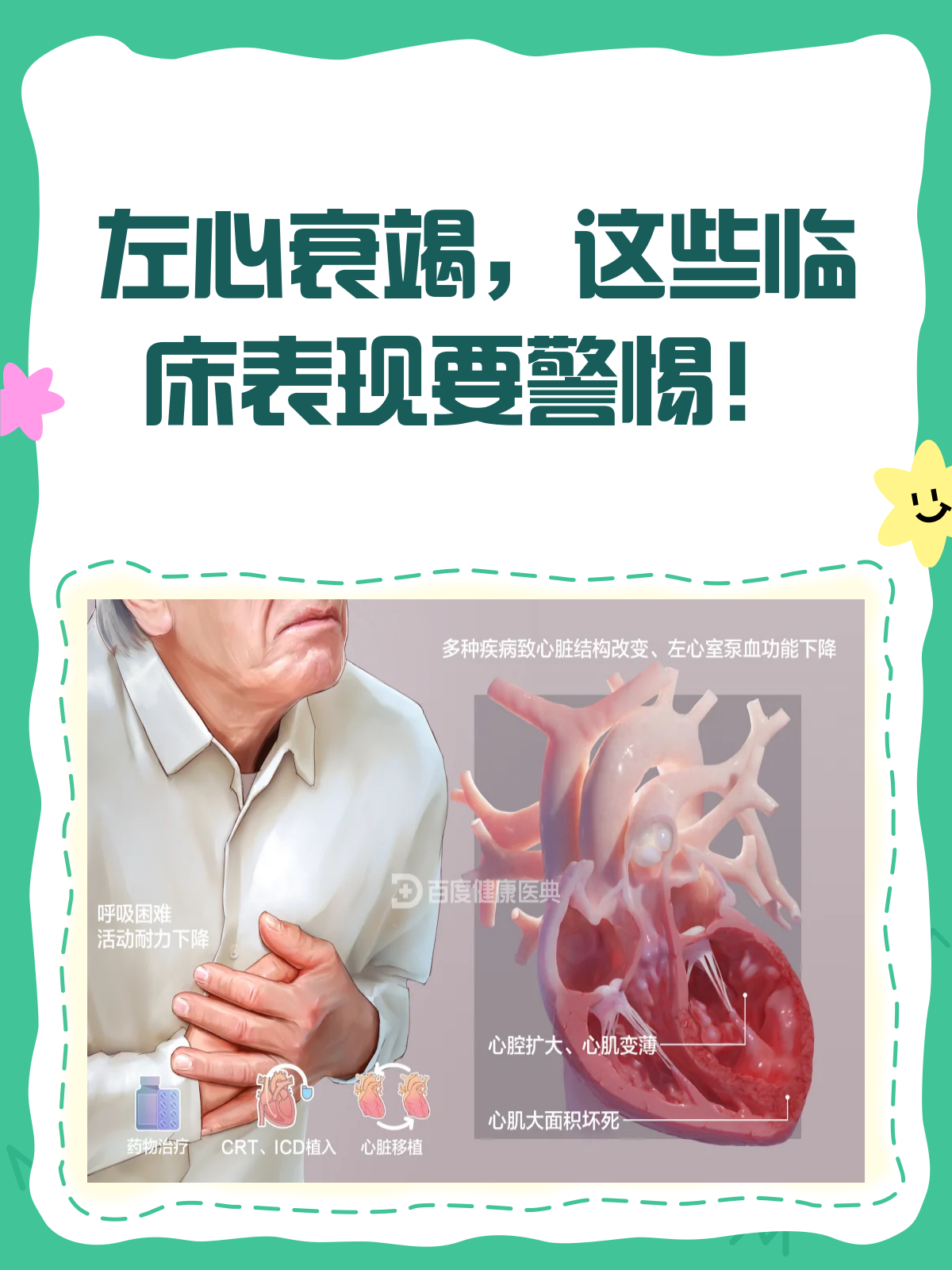 左心衰竭,这些临床表现你了解吗?