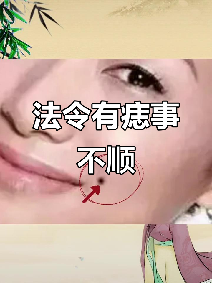 法令纹长痣影响事业,职场困境多
