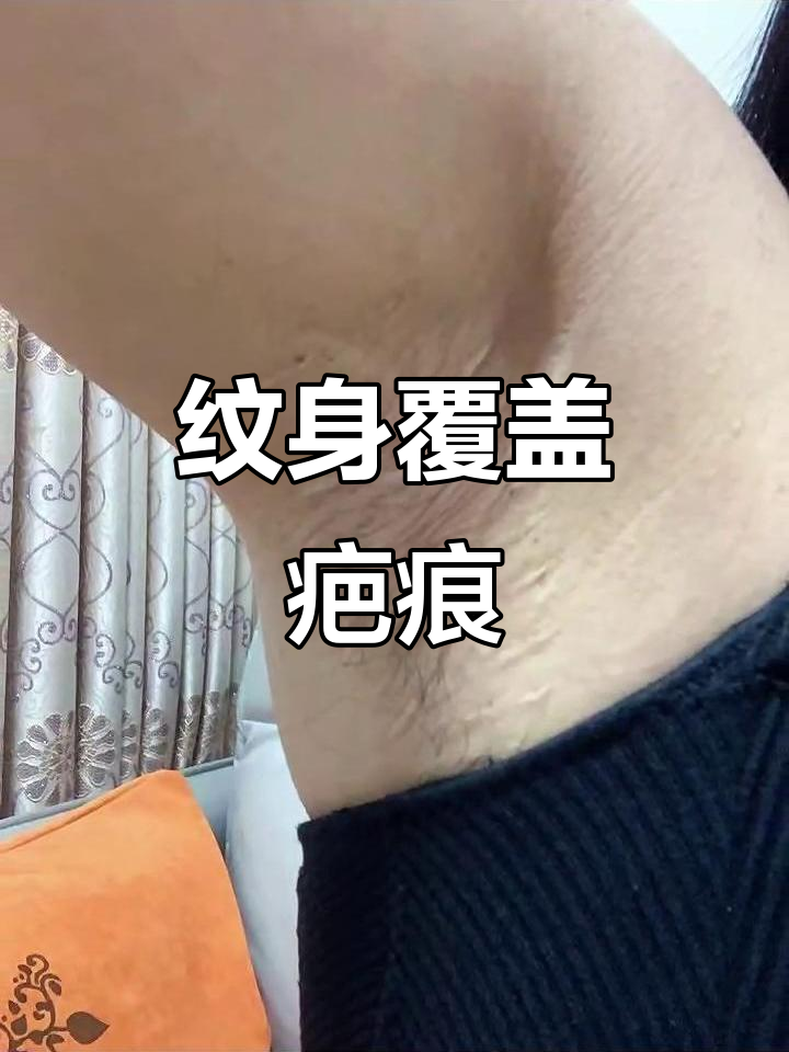 纹身的意义与美丽:用空星星月亮遮盖腋下疤痕