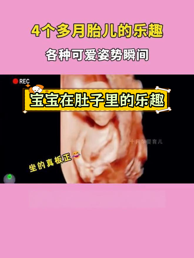 4个月胎儿的奇妙姿势,麻麻肚里好可爱