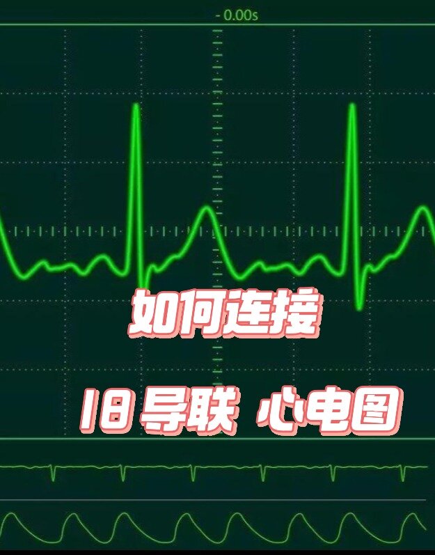 专业版//教你连接18导联心电图