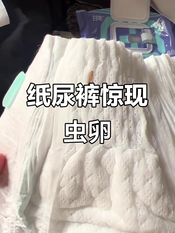 帮宝适纸尿裤惊现虫子,售后不回应,消费者维权无门