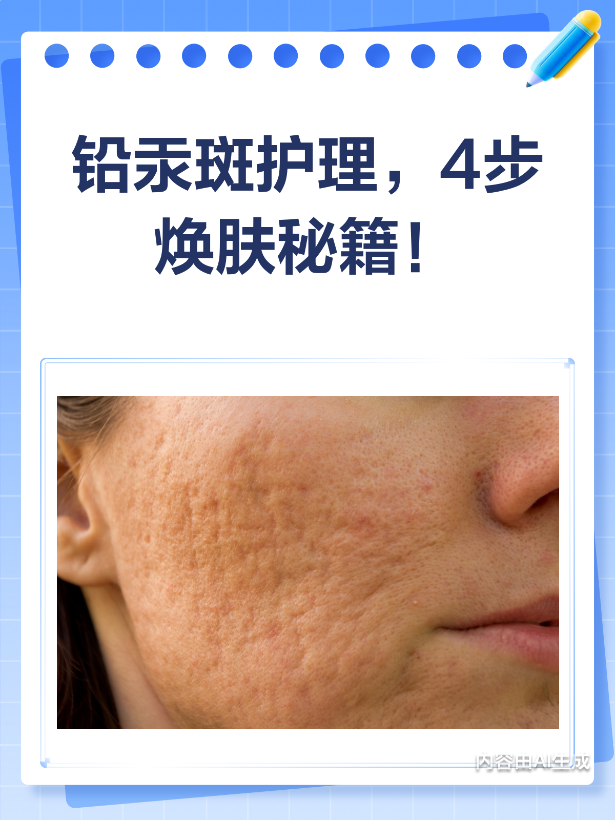 铅汞斑护理秘籍这4步让你告别肌肤烦恼!