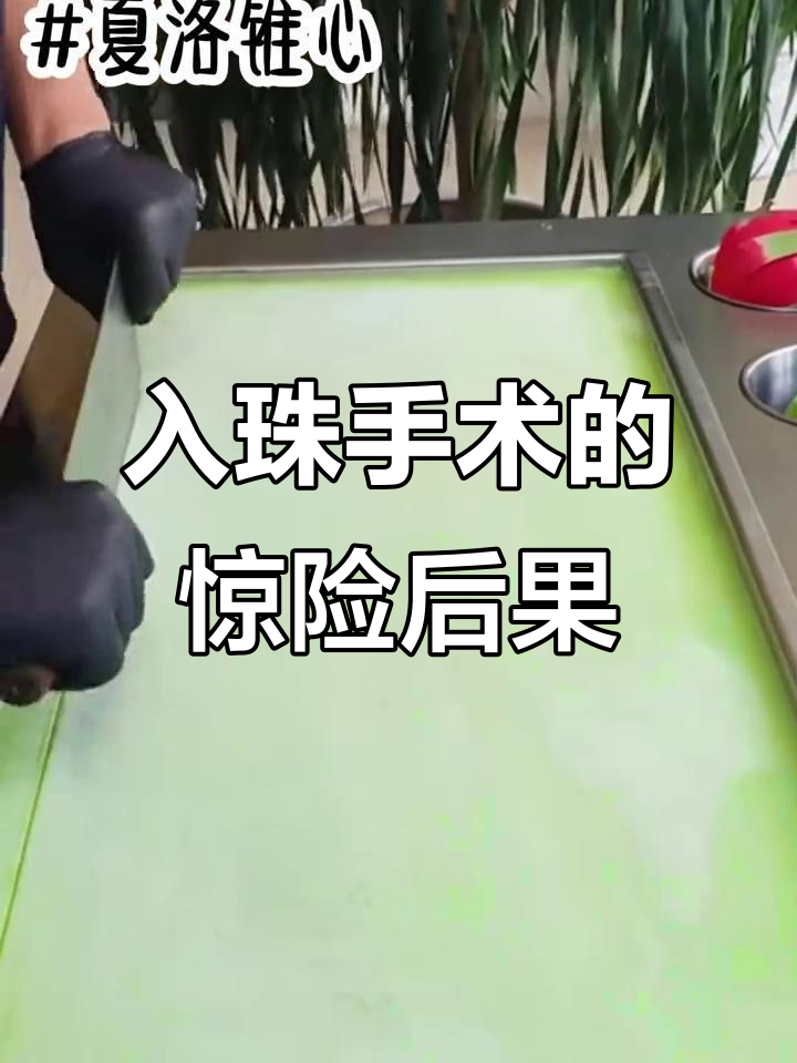 室友网恋奔现前做入珠手术,结果竟是这样!