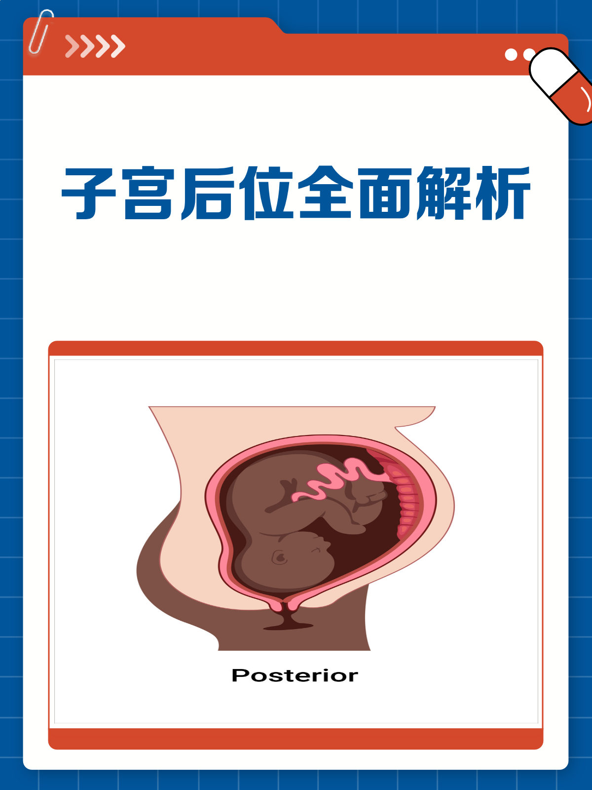 子宫后位是什么?一文带你全面了解