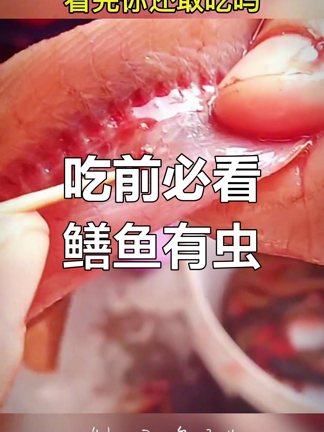 鳝鱼泥鳅寄生虫隐患,你敢吃吗?