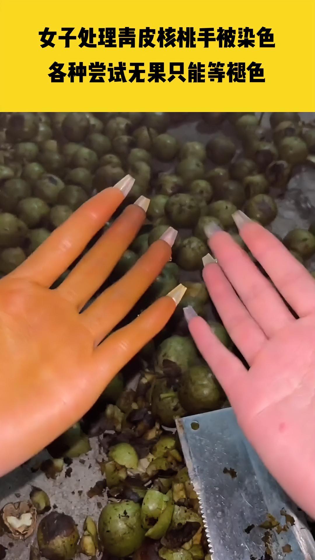 8月6日四川广安,女子处理青皮核桃手被染色,各种尝试无果只能等慢慢