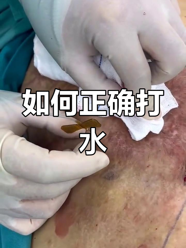 扩张器打水技巧全解析