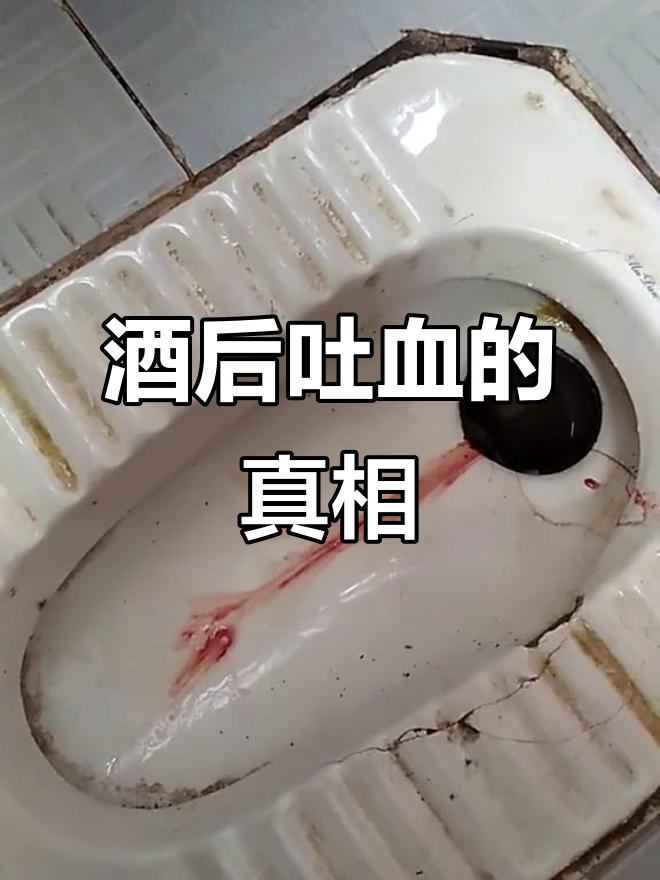 喝酒吐血,竟是因为这个原因!