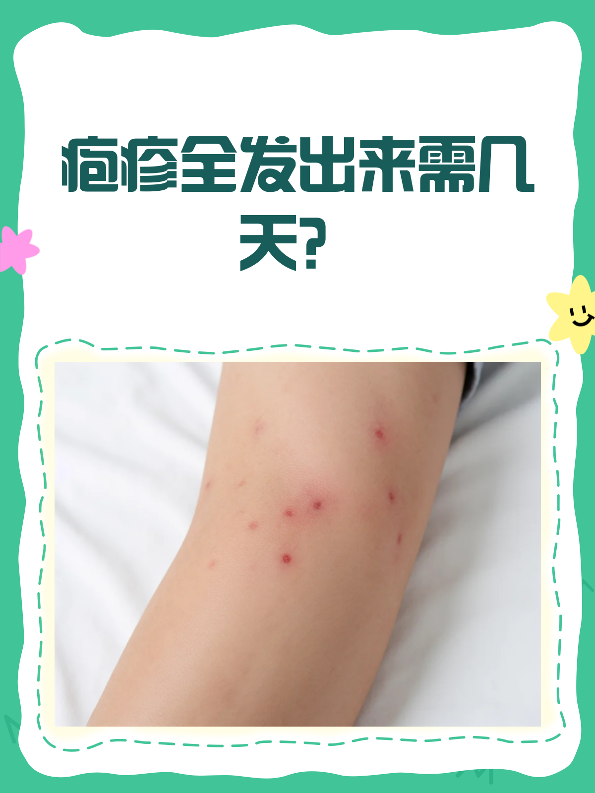 疱疹来袭,几天能"露真容"?