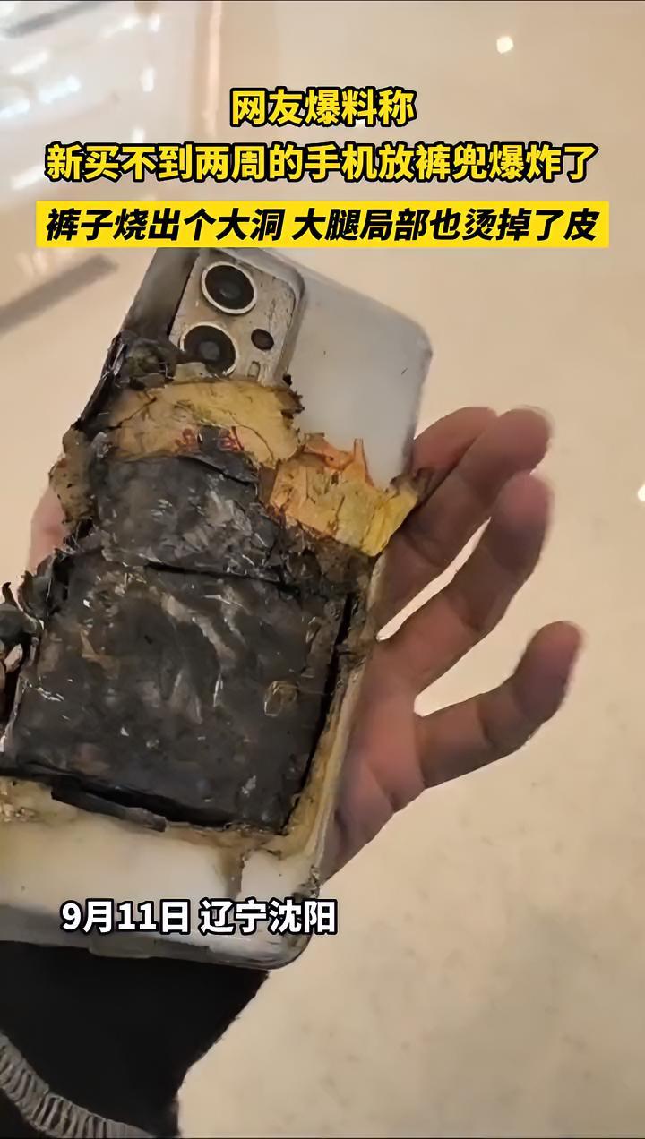 充电手机爆炸受伤图片图片