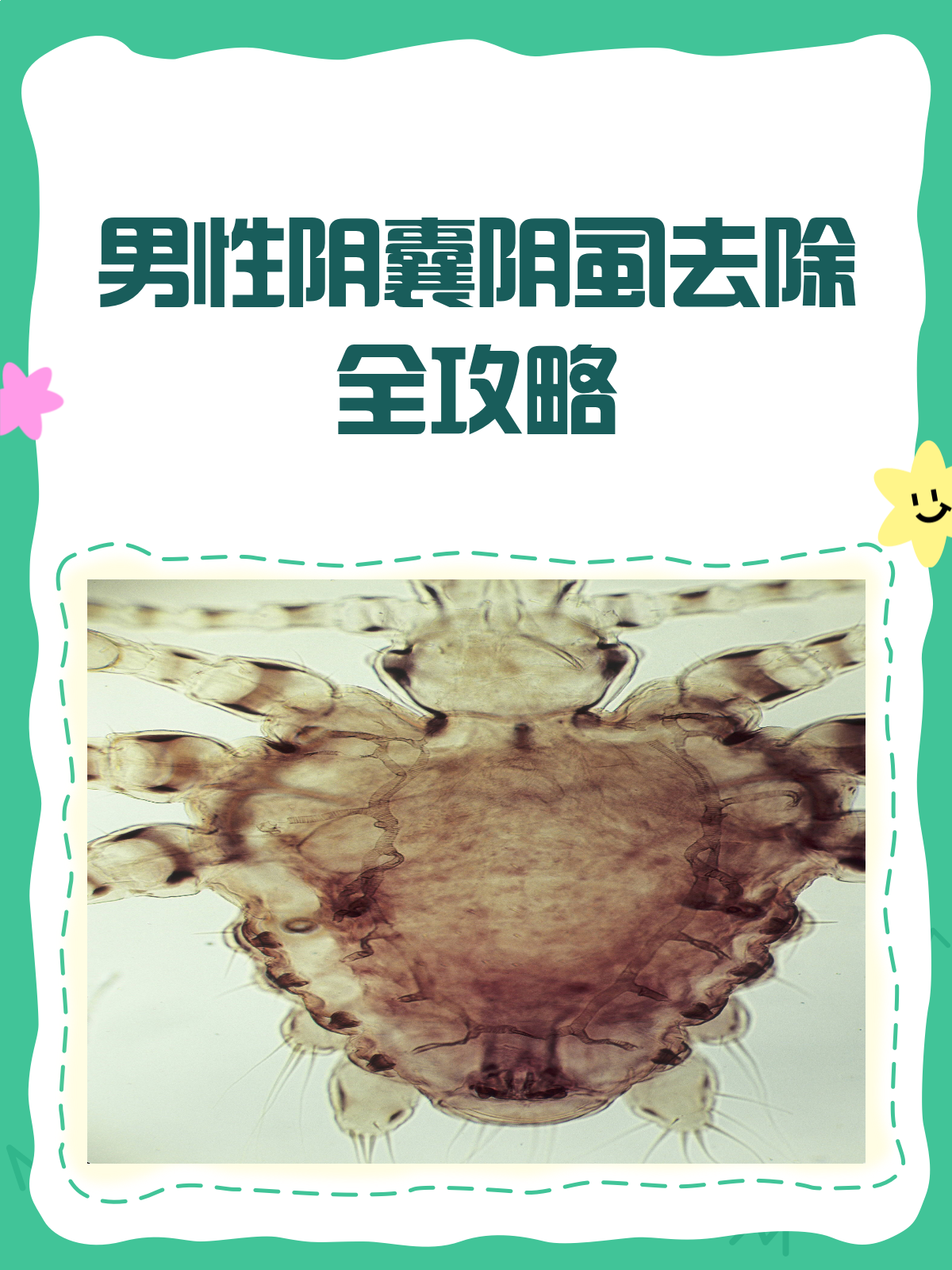 男性阴囊长虫子?别急,这样去掉!