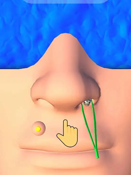 鼻子里有小虫子 解压小游戏 益智休闲小游戏 游戏流量风向标