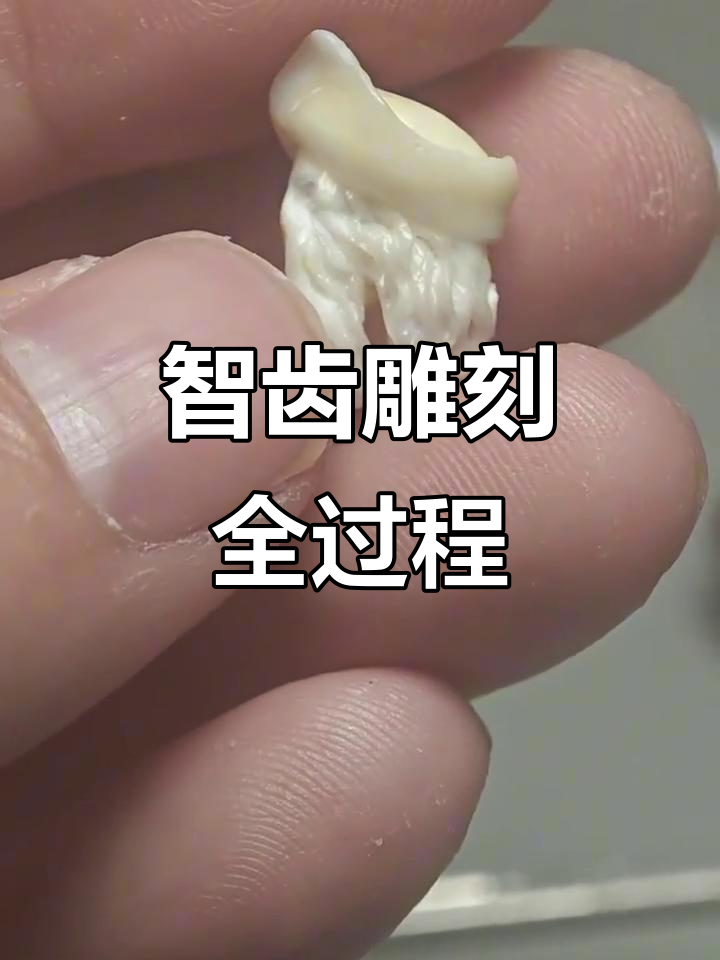 智齿雕刻大揭秘,爱牙人士必看!
