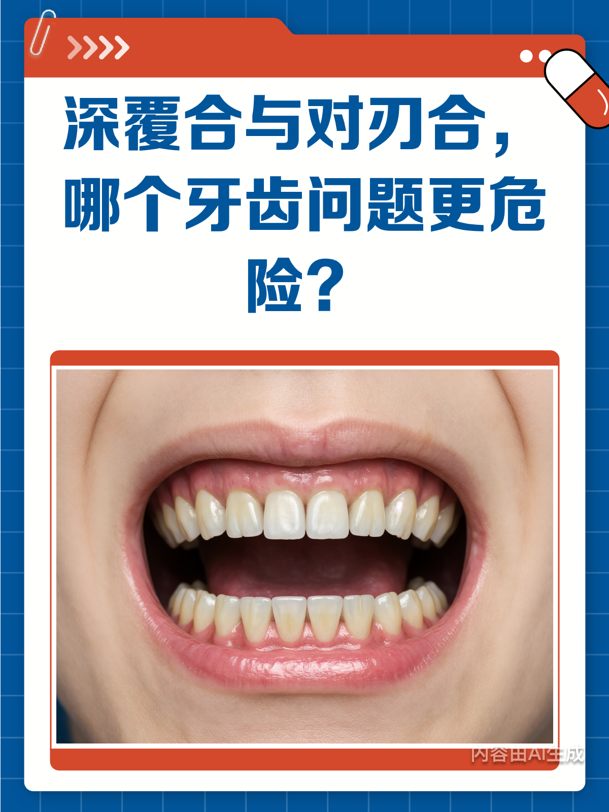 深覆合vs对刃合,你的牙齿属于哪种?