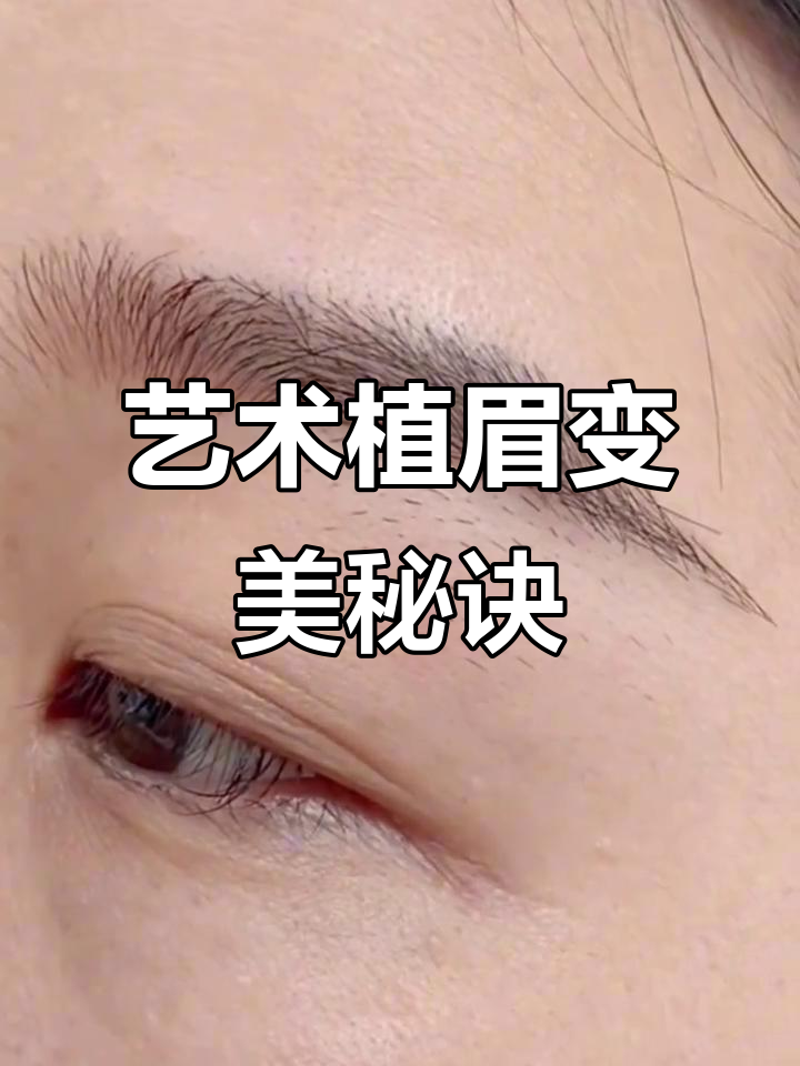 从"无眉大侠"到气质满分,艺术植眉让你焕然一新