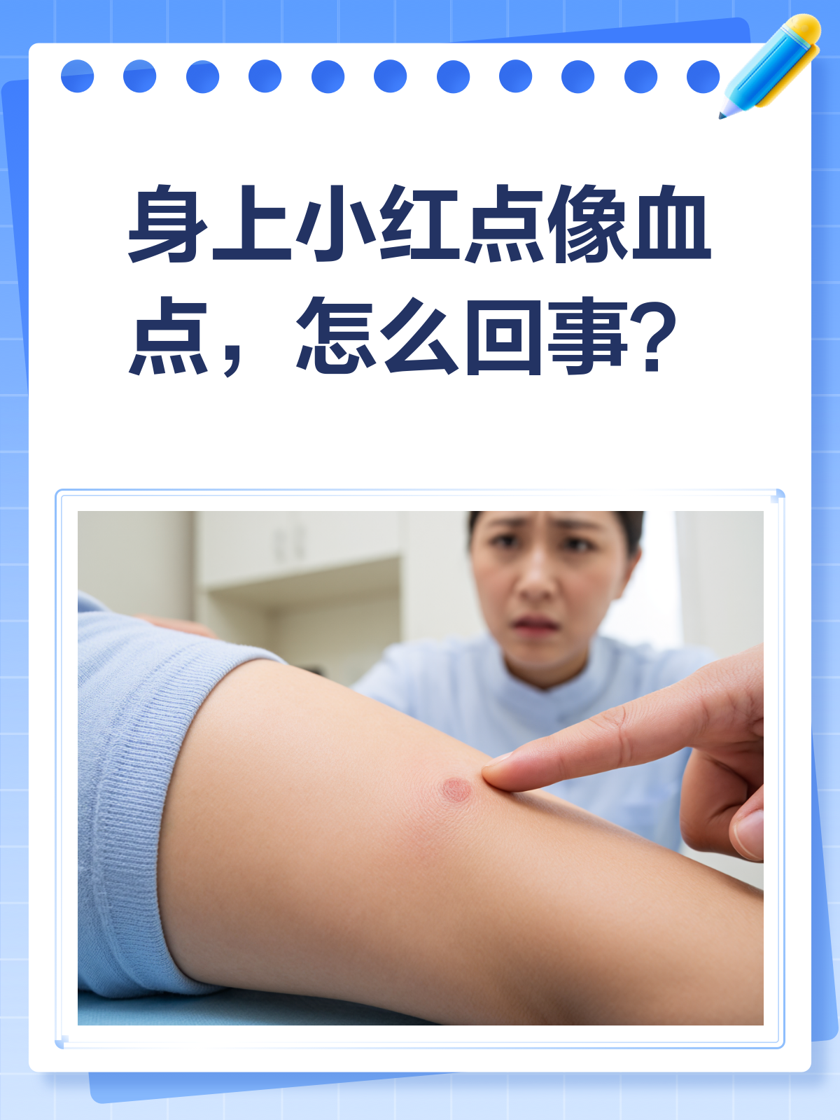 身上出现小红点像血点?别急,先来看看这个!