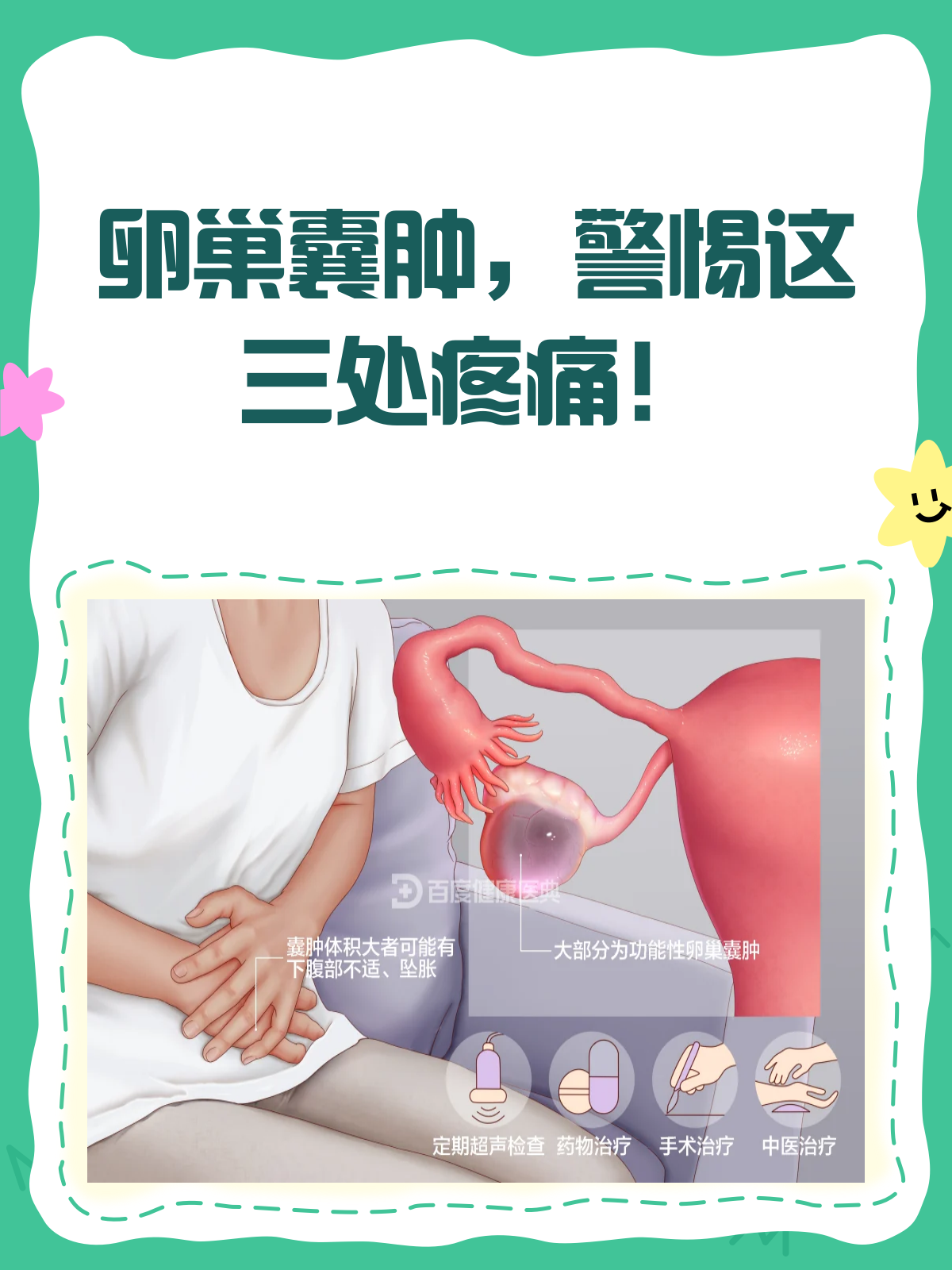 为什么会长卵巢囊肿