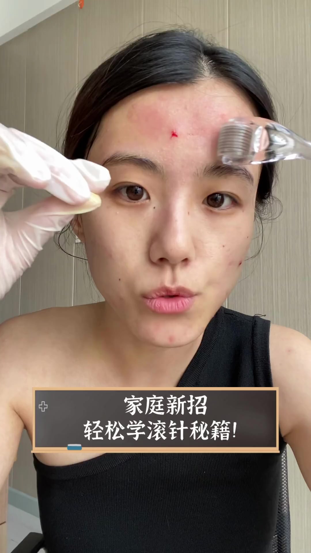 滚针美容效果怎么样