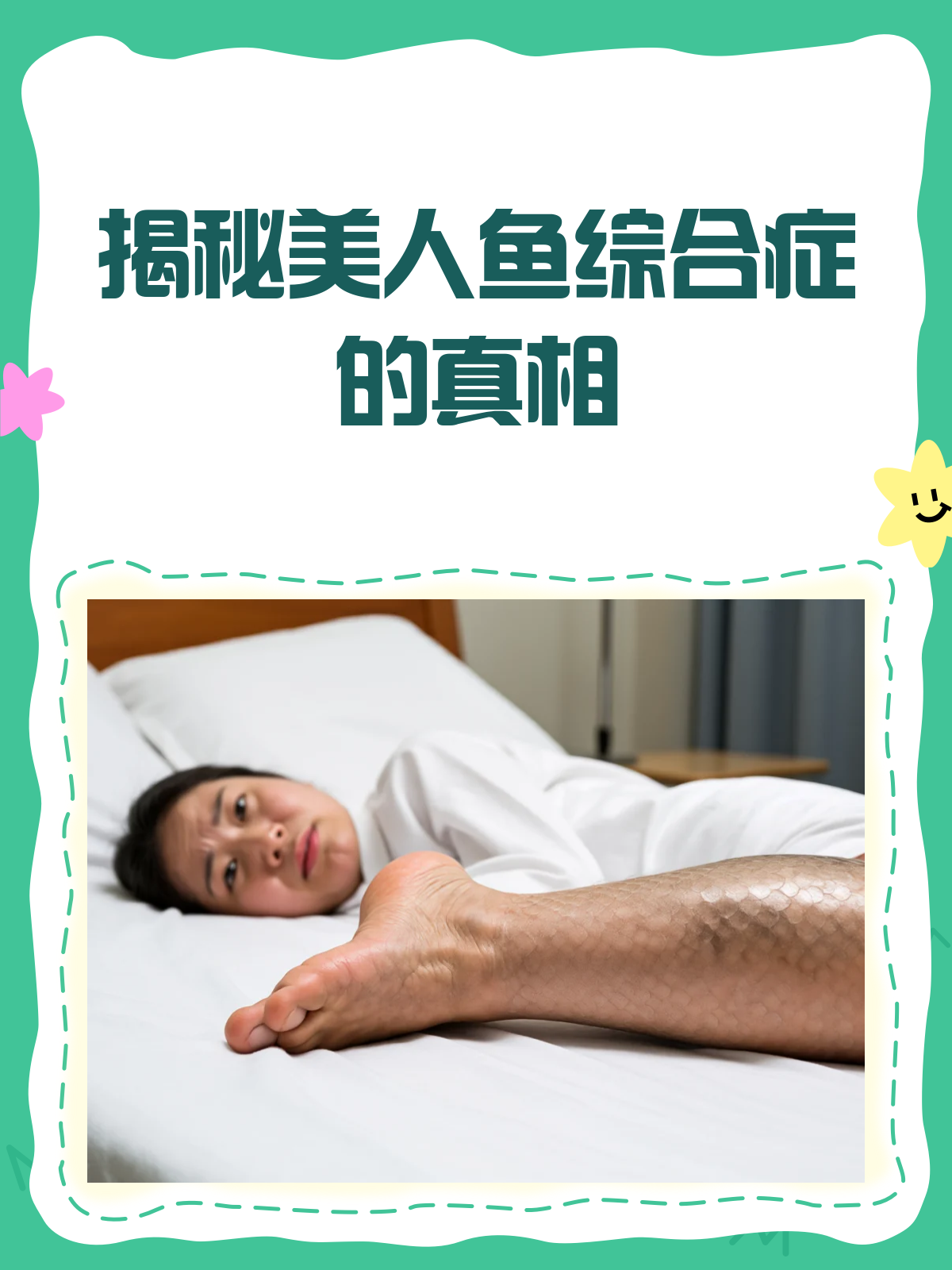 揭秘美人鱼综合症♀,你真的了解吗?