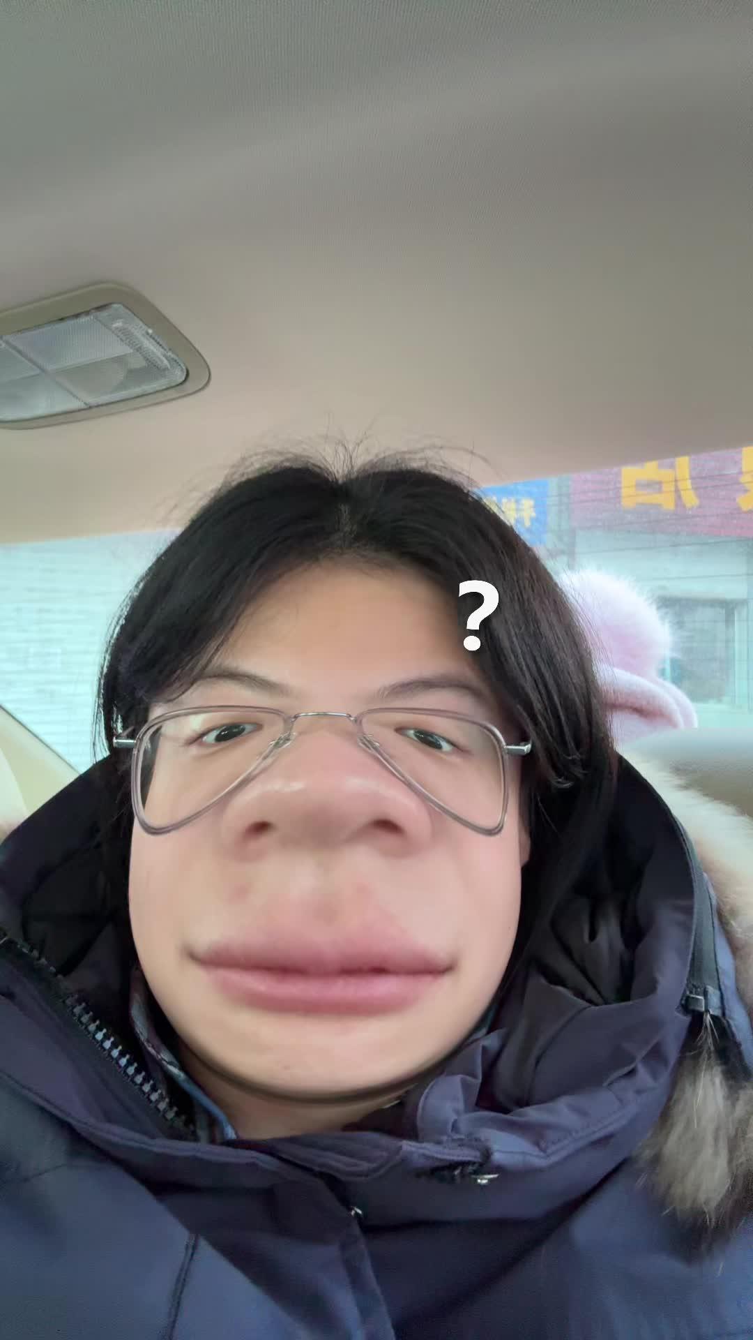 大门牙