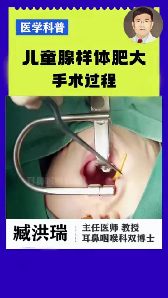 沉侵式观看儿童腺样体肥大手术